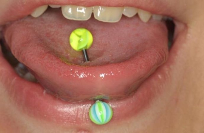 Imagen de una persona con un 'piercing' lingual