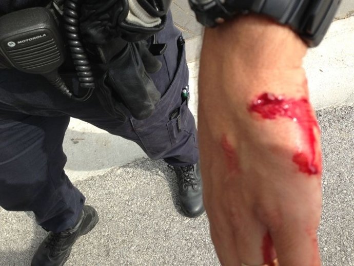 Agente policía herido por perro