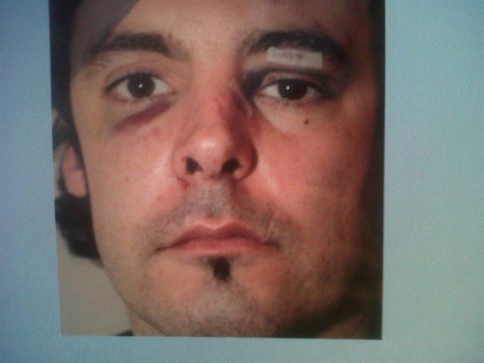 Foto del agredido