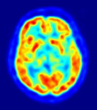 Más de un tercio de las neuronas se renuevan periódicamente