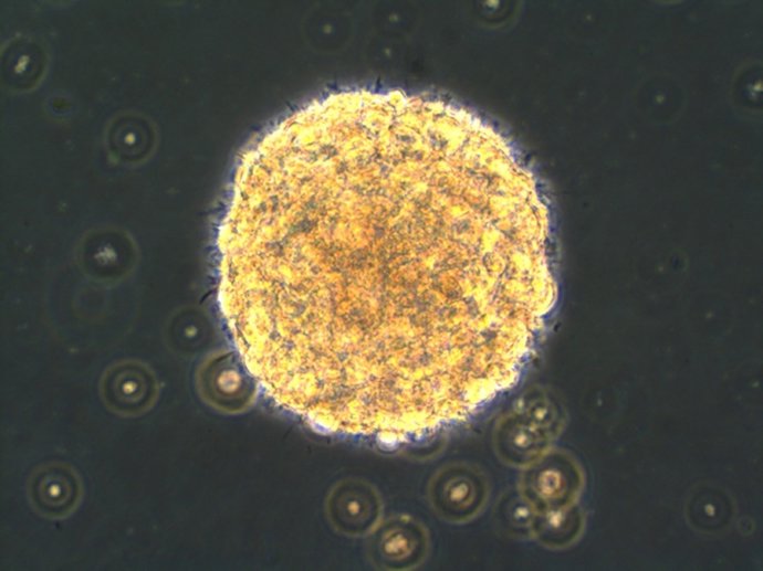 Imagen de una neuroesfera visible