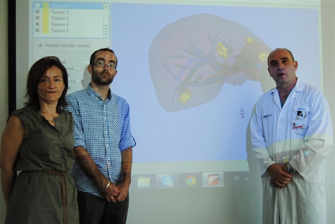 INVESTIGADORES DESARROLLAN EL SOFTWARE 'HEPAPLAN' 