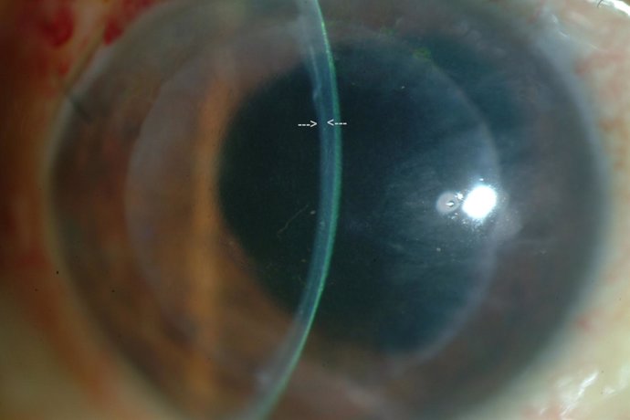 Imagen detalle de la córnea de un globo ocular