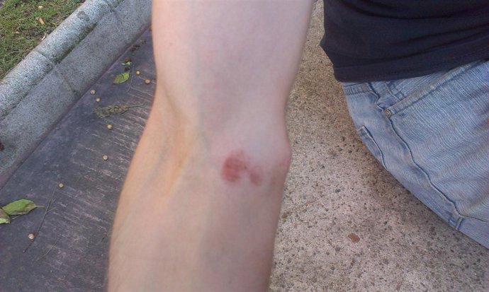 Presunta agresión denunciada por Arran