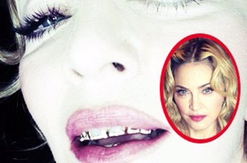Madonna se pone dientes de oro