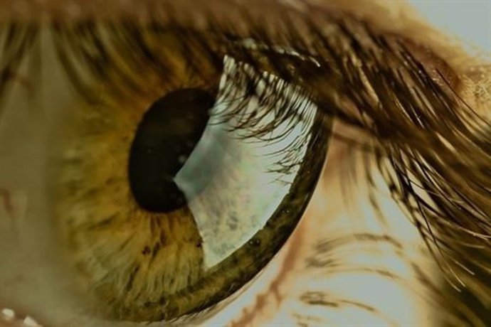 Te cambian el color de ojo