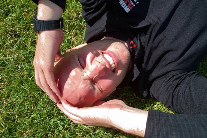 Calvo, calvicie, dolor, sol, rojo