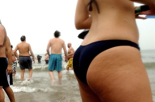 Playa y una con celulitis 