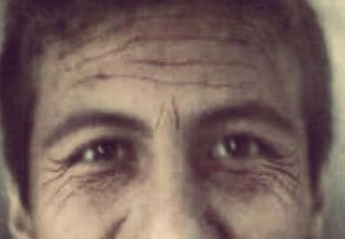 arrugas