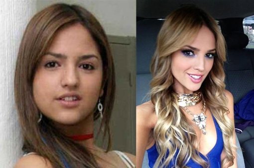 ANTES Y DESPUES DE EIZA