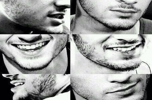 La operación de la sonrisa permanente 