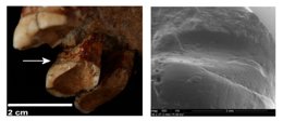 Imágenes del surco en una dentadura neandertal provocado por el uso de palillos
