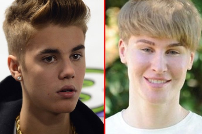 Un fan se opera la cara para parecerse a Justin Bieber