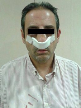 Autobusero agredido tras pedir a un viajero apagar el cigarrillo electrónico