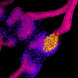 Primordio de riñón obtenido a partir de células madre humanas