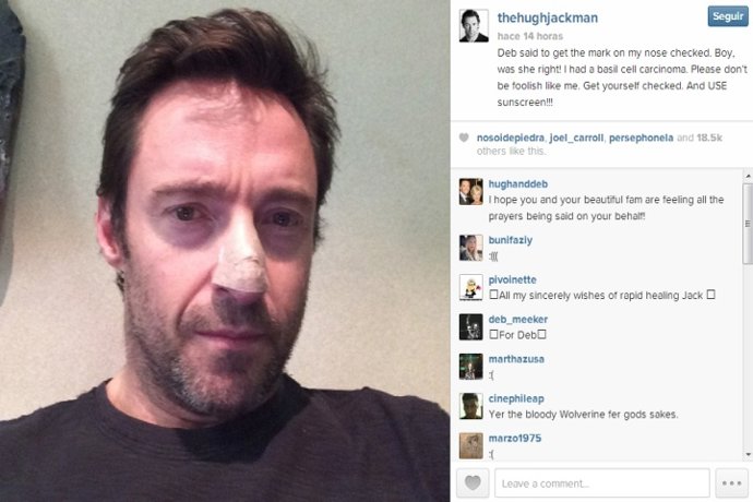 Hugh Jackman revela que padece cáncer de piel