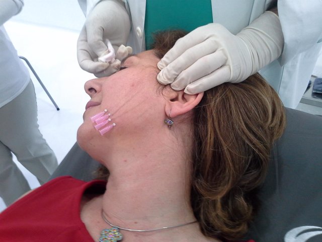 Hilos tensores rejuvenecimiento facial push-up clinico menorca