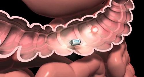 Una cámara píldora que pretende acabar con las colonoscopias