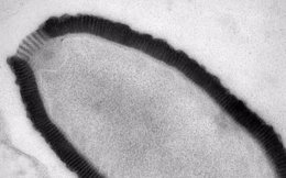 Resucitan virus gigante congelado durante 30.000 años