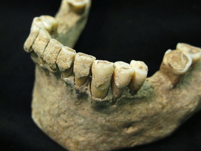 La UV participa en estudios sobre placa dental