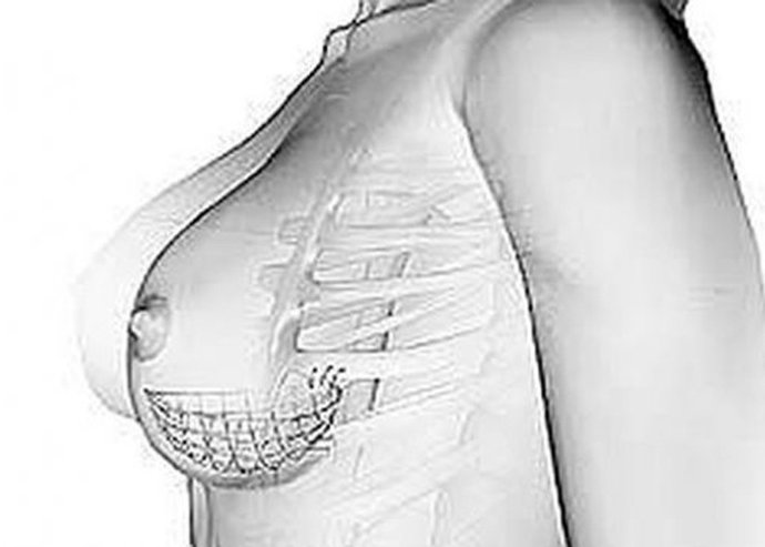 La revolución para el pecho caído: el sujetador interno