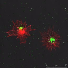 Células dendríticas afectadas por la invasión del virus del sida