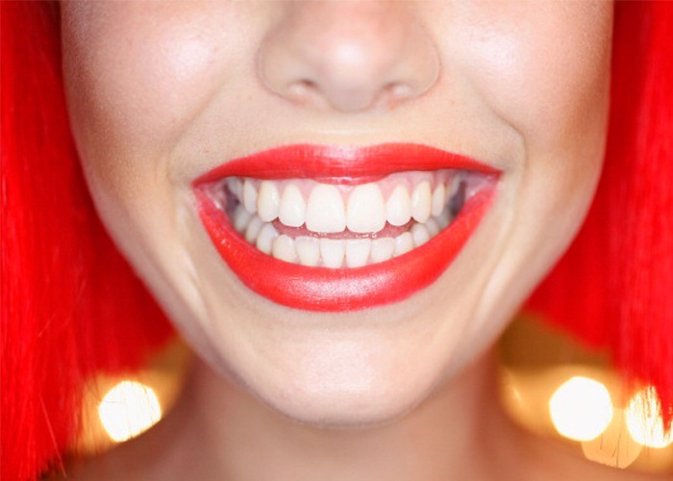 Blancorexia: la obsesión por los dientes blancos que provoca problemas en nuentr