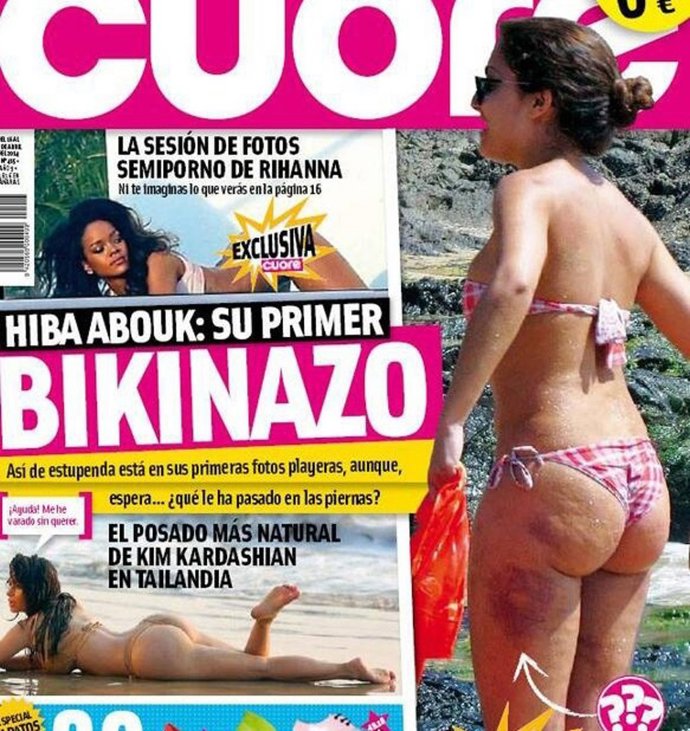 Hiba Abouk luce tipazo y piernas repletas de cardenales