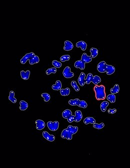 Cromosomas anómalos en células reprogramadas a las que se les ha eliminado la pr