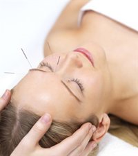Acupuntura para combatir el dolor