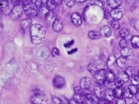 Detectan una proteína que ayuda a frenar el cáncer