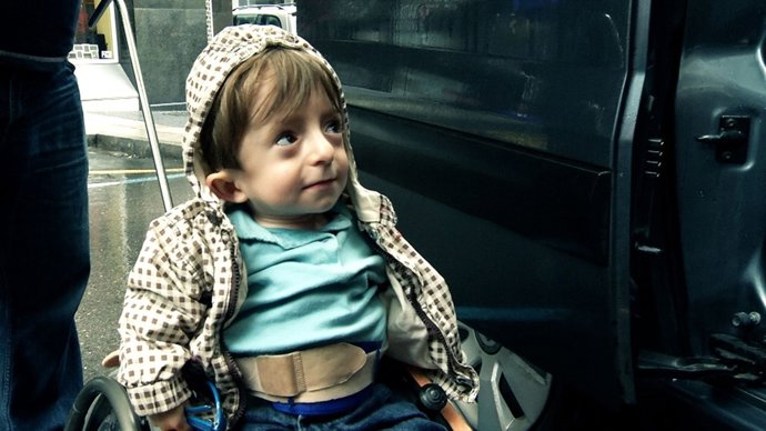 Lucas "el niño de cristal" de Torrelavega