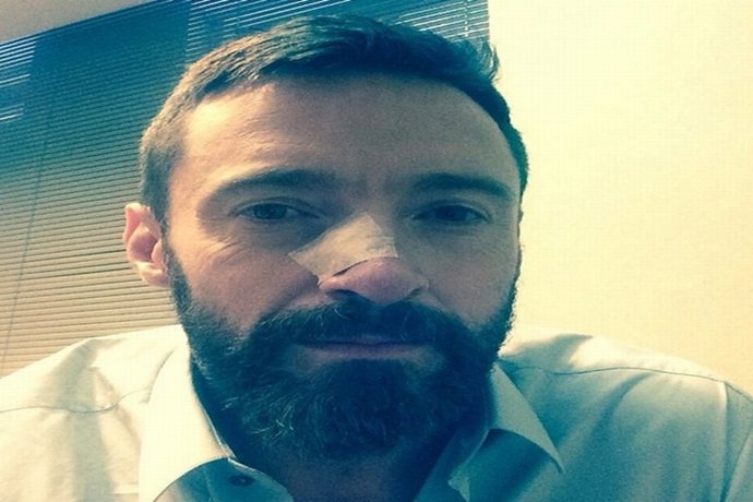 Hugh Jackman sufre de nuevo cáncer de piel