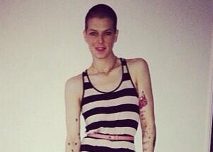 Bimba Bosé se recupera de su operación de cáncer de mama