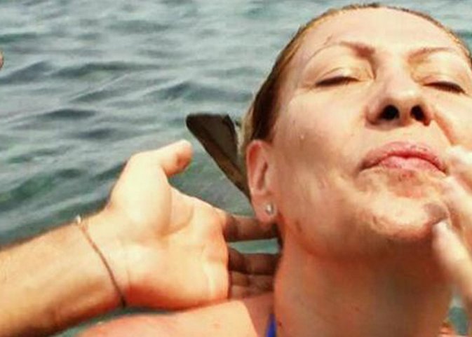 Rosa Benito se arregla el diente