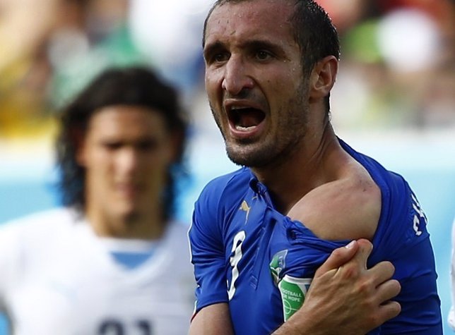Italy's Giorgio Chiellini shows his shoulder, claiming he was bitten by Uruguay'
