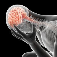 Reducir el riesgo de ictus