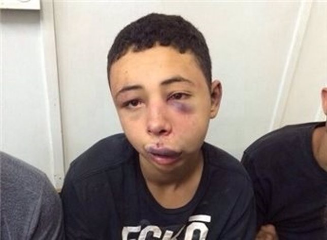 El joven palestino Tarek Abú Judair, linchado por policías israelíes
