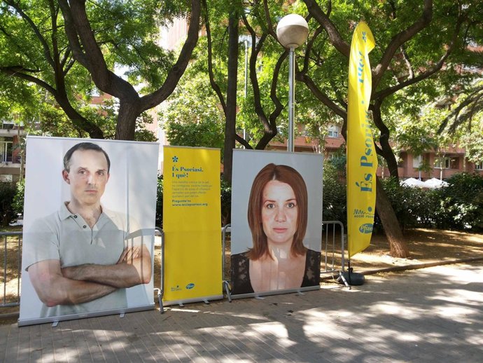 'Es Psoriasis ¡Y Qué!'