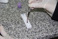 El diagnóstico temprano de VIH no es fácil ni para el médico