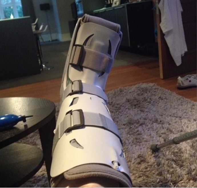 Álvaro Negredo muestra su pierna lesionada