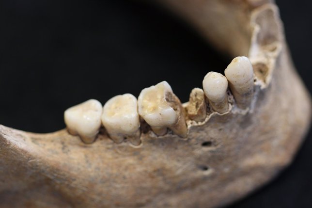 Evolución genética de las caries estudiada por la UAB