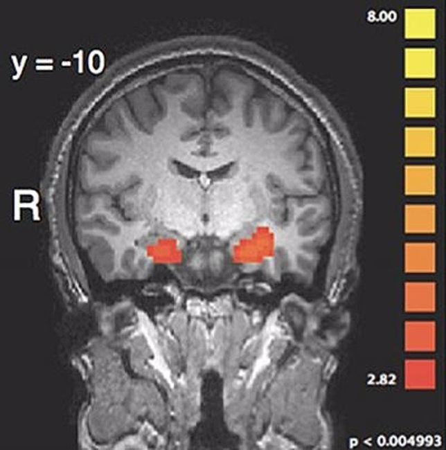 Cerebro