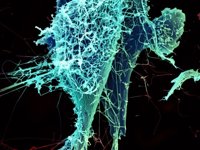 Ebola.- Surten del Carlos III les UCI mòbils que van traslladar el religiós, amb conductors amb màscares