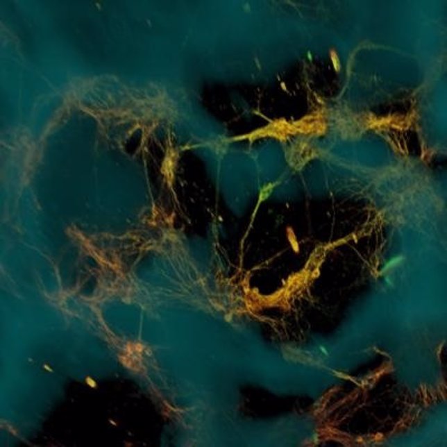 Bioingenieros crean tejido cerebral funcional en 3Dm