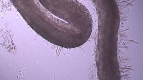 Tentáculo de medusa