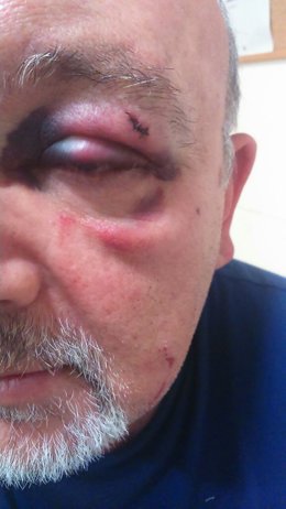 Auxiliar de enfermería agredido en el Clínico de Málaga