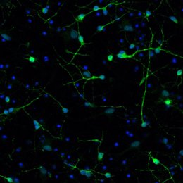 Neuronas Estudiadas Por La UAB