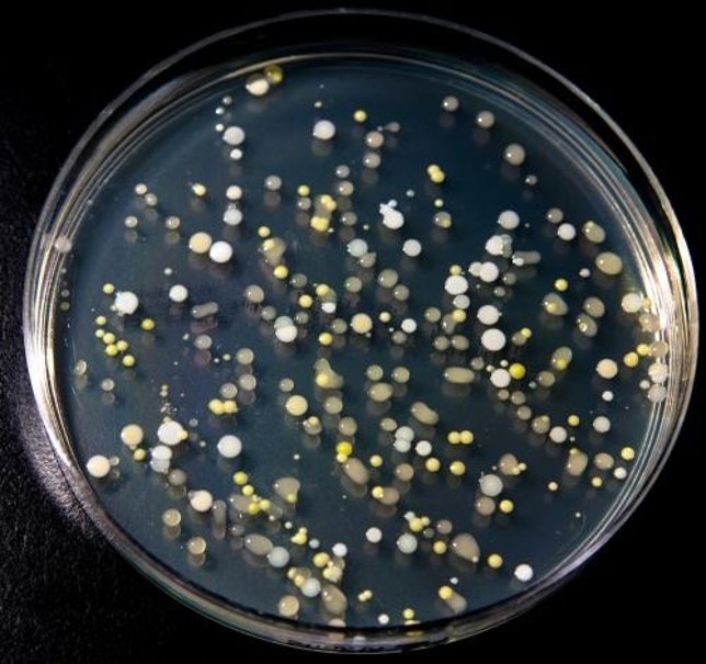 Microbios