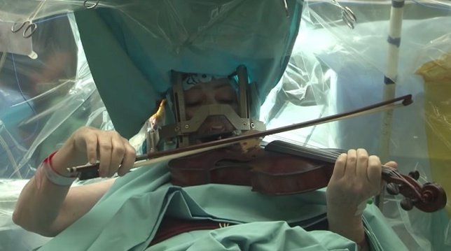 Violinista israelí es intervenida del cerebro mientras toca el violín